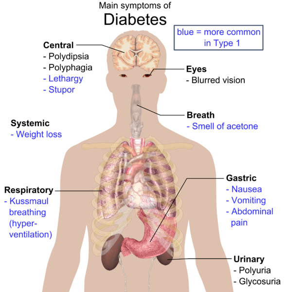 Soubor:Main symptoms of diabetes.png