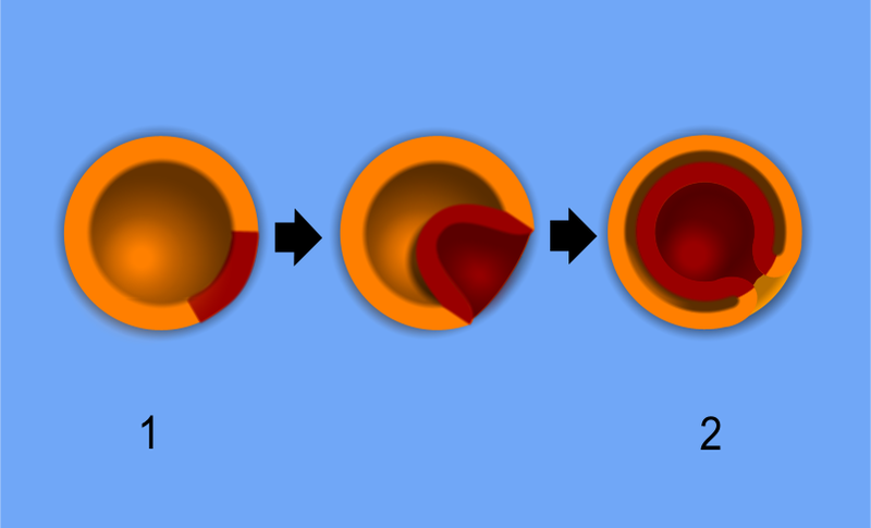 Soubor:Gastrulation.png