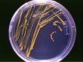 Agar plate with colonies.jpg