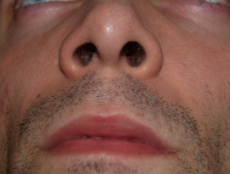 Soubor:Nostrils by David Shankbone.jpg